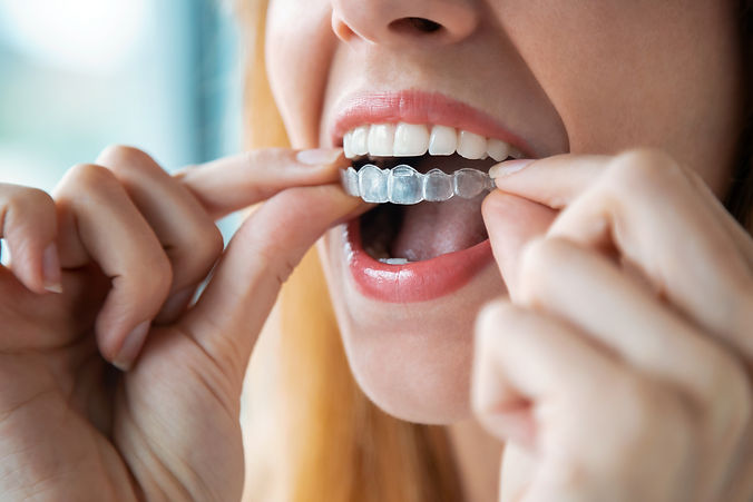 Emergency-Dentist-Melbourne-Invisalign.jpeg