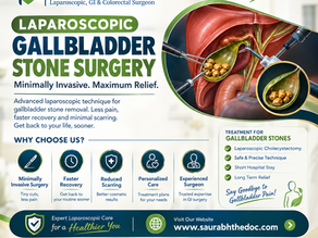 Laparoscopic Gallbladder Stone Surgery for Safe and Effective Treatment