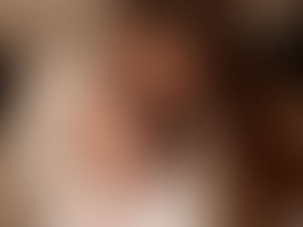 Le frein de lèvre est-il un problème ?