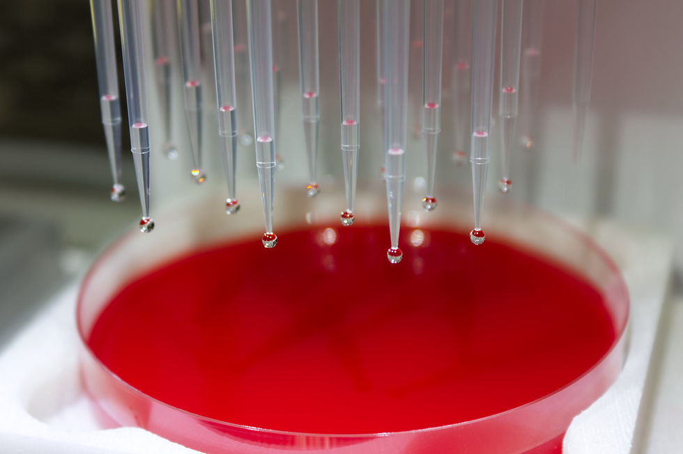 Jednodenní EUCAST kurs testování citlivosti - on-line za hubičku!