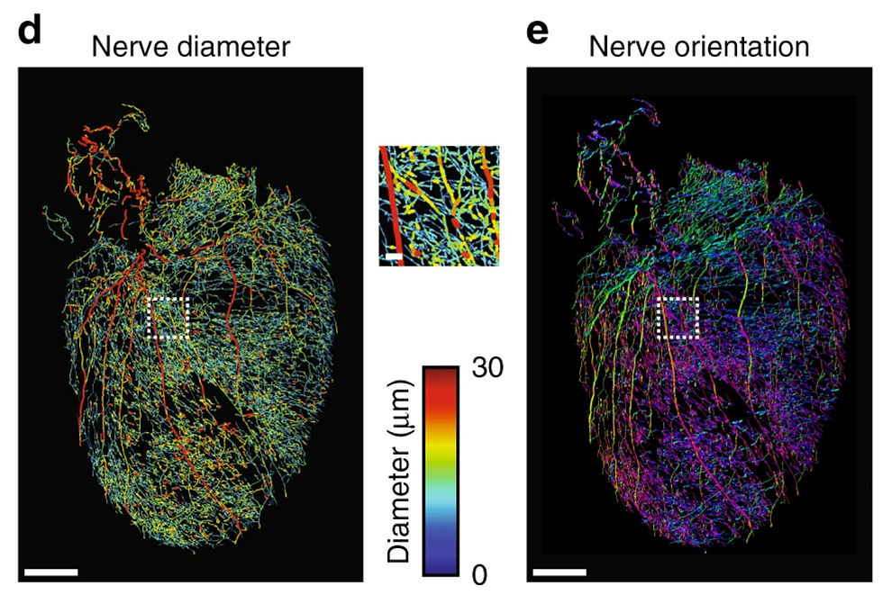 Peripheral (Vagal) Nerves regulating Heart Rate (https://pubmed.ncbi.nlm.nih.gov/31028266/)