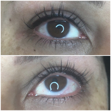 Upper Eyeliner