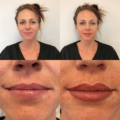 Full Lip Color