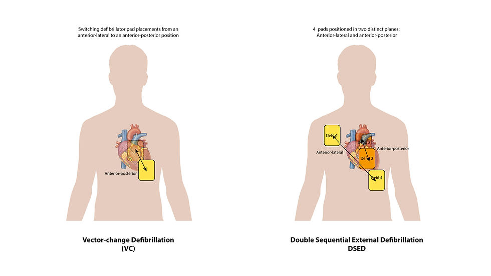 Vector-change and Double Sequential External Defibrillation