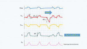 End-expiratory Occlusion test and the assessment of transpulmonary pressure