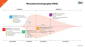Thromboelastography (TEG) is a Better Indicator of Hemostasis in Cirrhotic Patients