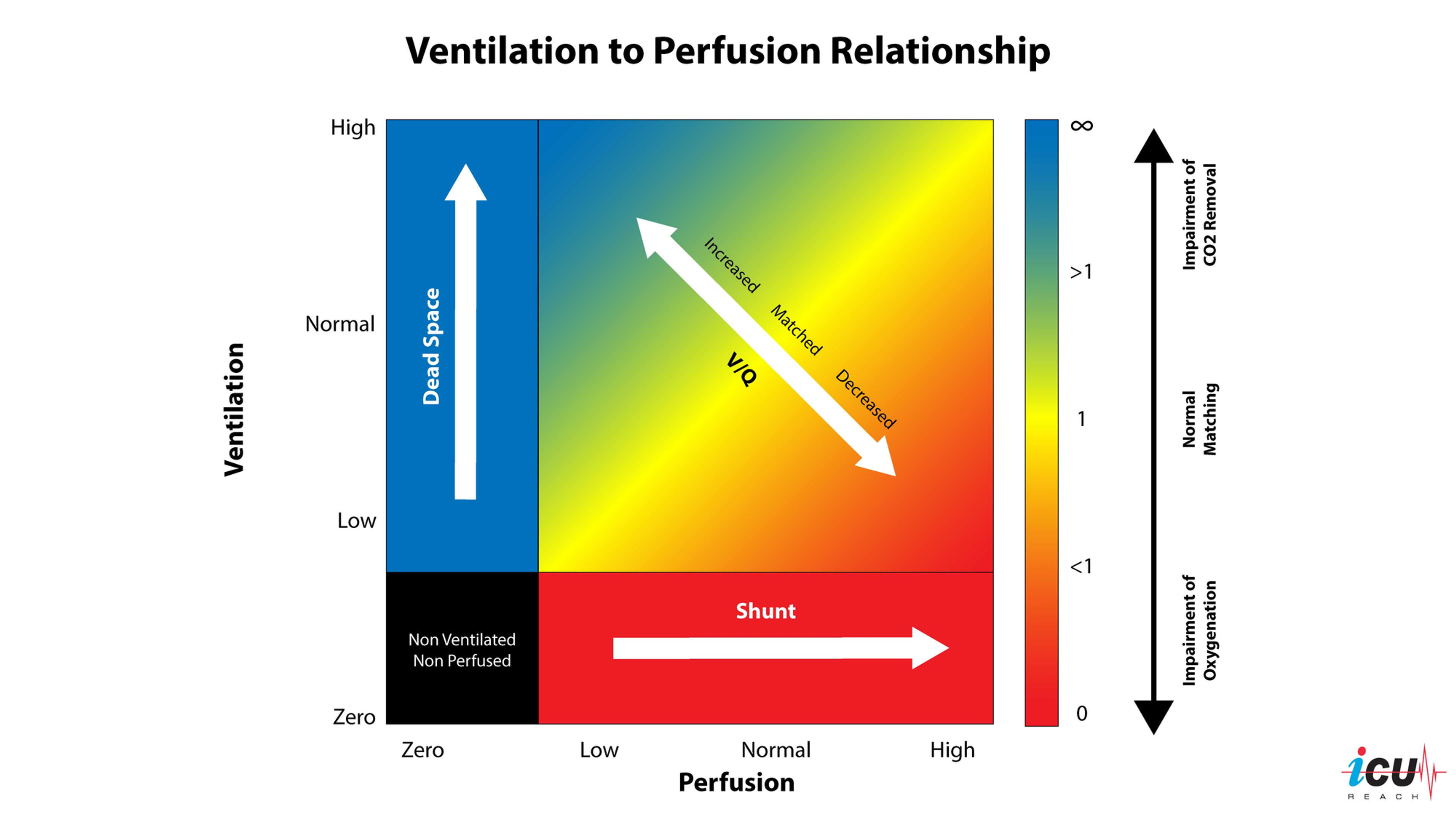 Ventilation/Perfusion Relationship