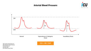 Diastolic Shock Index: What it Means and how is it Interpreted?