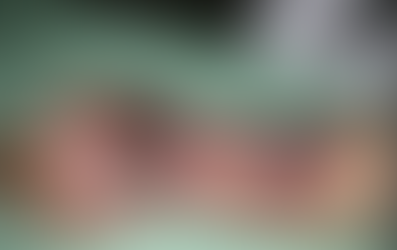 When Should a Central Venous Catheter Be Placed for Vasopressor Infusion?