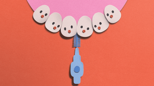 Studio PI_Harriet Noble_Tepe Teeth x The Times.gif