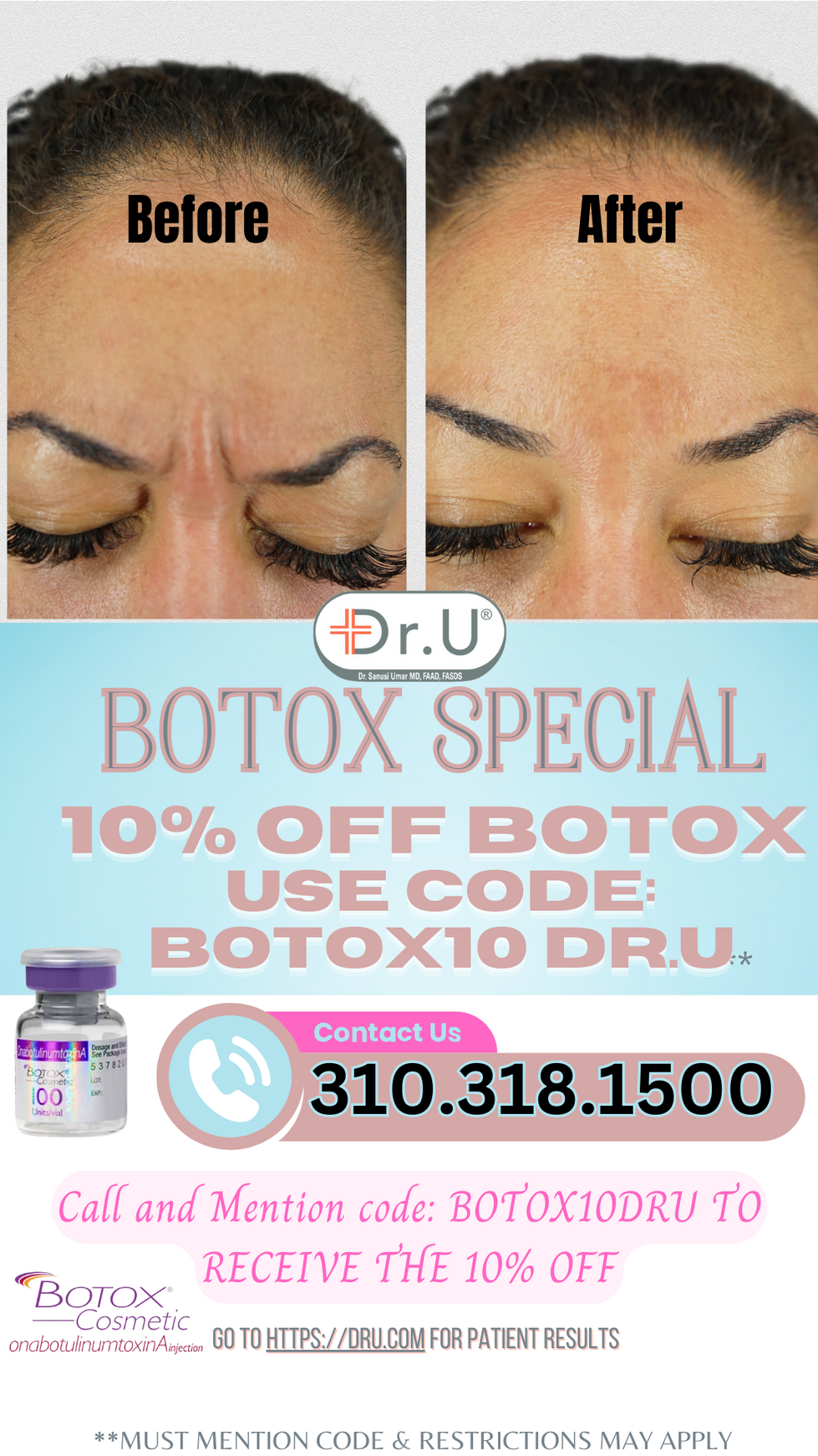 (3 examples) Botox campaign 10- off with  SM code... (17)-1.png