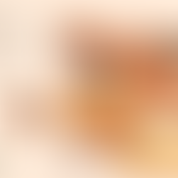 조건 공개가 표준이 되었다