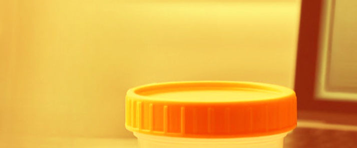 Klemmbrett Laptop Probenbecher_edited_ed