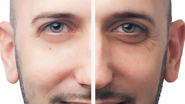 Ojeras