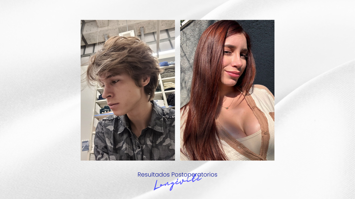 "Antes y después de un caso de éxito en la clínica Longevité, mostrando resultados de [nombre del procedimiento] y resaltando la evolución estética y armonía facial/corporal lograda."