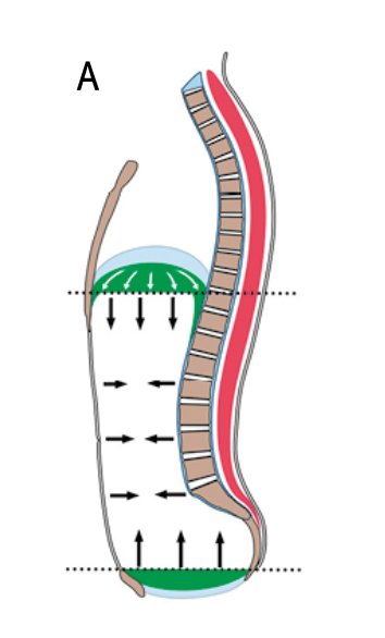 Good alignment with parallel arrangement between diaphragm and pelvic floor