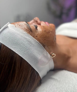 matrix-facial-treatment-salem-wi.jpg