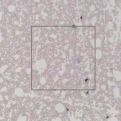hematology blood differencial