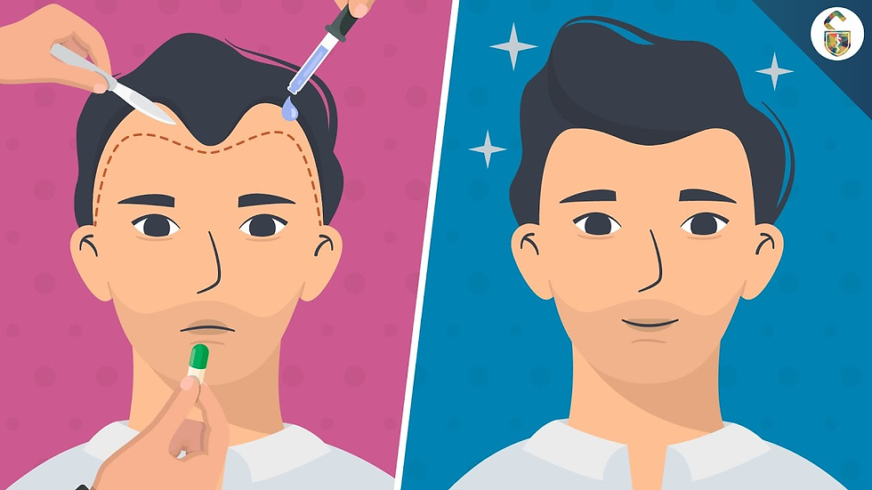 The vast majority of hair loss is nonscarring. It includes such conditions as pattern baldness and telogen effluvium, or excessive hair shedding. The majority of hair loss in both men and women is pattern baldness, also referred to as androgenetic alopecia. Both genetic (family) and hormonal factors play a role in pattern baldness.