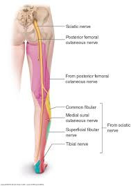 Is it Really Sciatica?