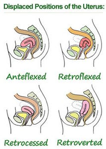 couple's fertility - heterosexual couples - bloom - here