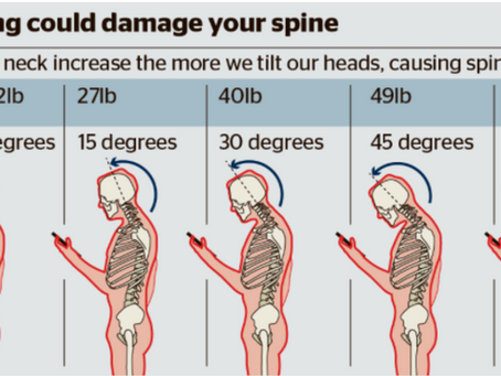 How to Fix Your Text Neck and Get Rid of Your Pain