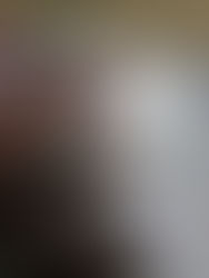 Safe Abortion Pills In Limpopo