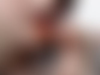 Safe Abortion Pills In Kempton Park