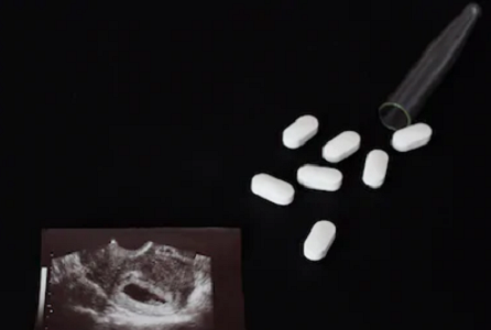 Safe Abortion Pills In Randburg