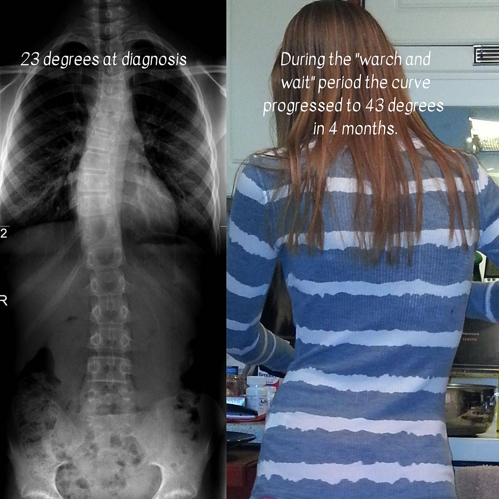 The Inspiration for Brace Buddies