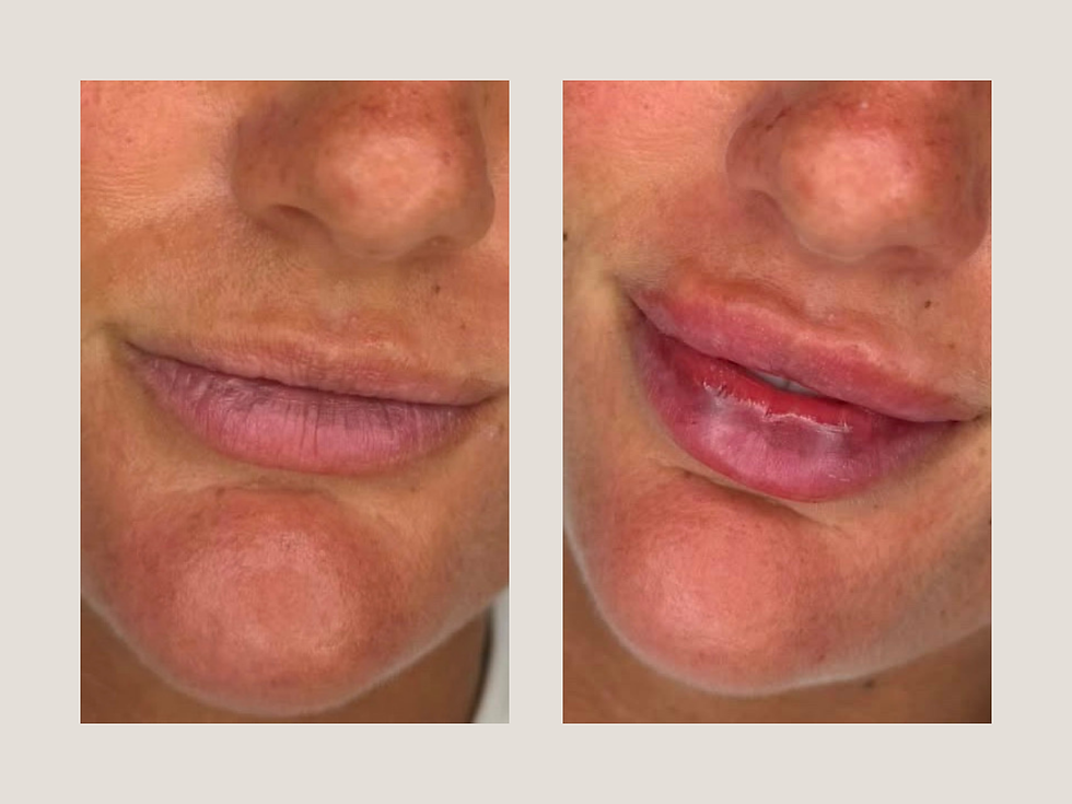 Lips B Collage (1200 x 900 px)