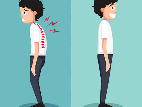 Why You Should Be Taking Your Posture More Seriously