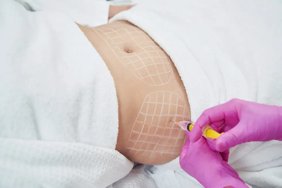 Lipolysis Fat Reduction