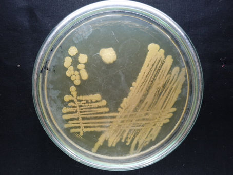 Bacillus megaterium in phosphorus solubilization