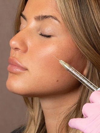 skin boosters profhilo syros