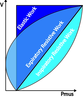 Work of Breathing PICU Forced Expiration