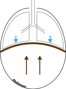 APrElement 3_2x.png