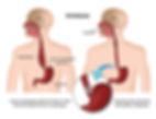 drawing of human body with oesophagus and stomach