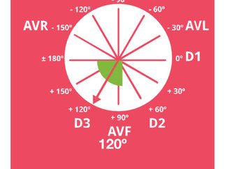 ECG Práctico