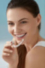 aligners-for-page-).jpg