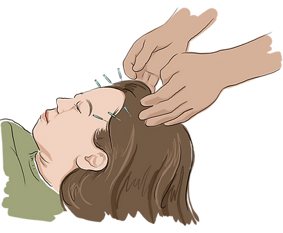 accupuncture.png