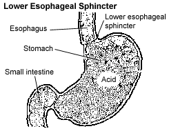 Lower Esophageal Sphincter