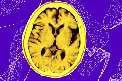 KLINIKUM+ | The hidden Gem of ADmit Therapeutics