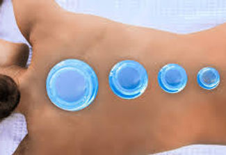 cupping.jpg