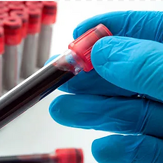 Dr. Segnini flebotomía a domicilio, toma de muestras, extracción de sangre, laboratorio clínico, servicio a domicilio.