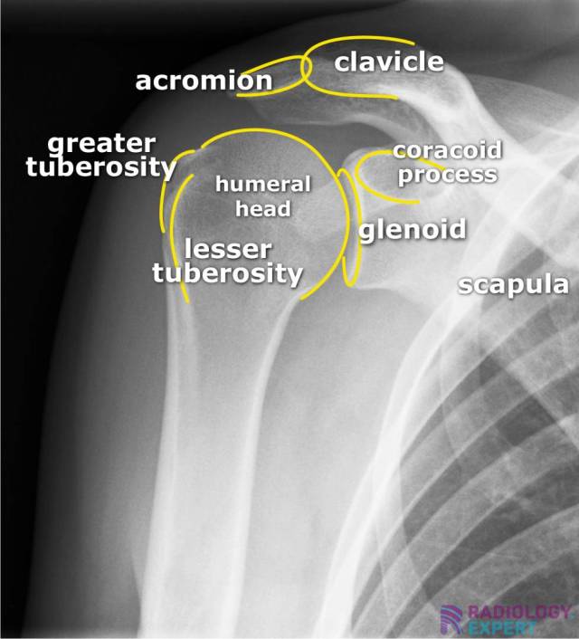 Glenohumeral joint radiograph shoulder anatomy acromion clavicle humerus