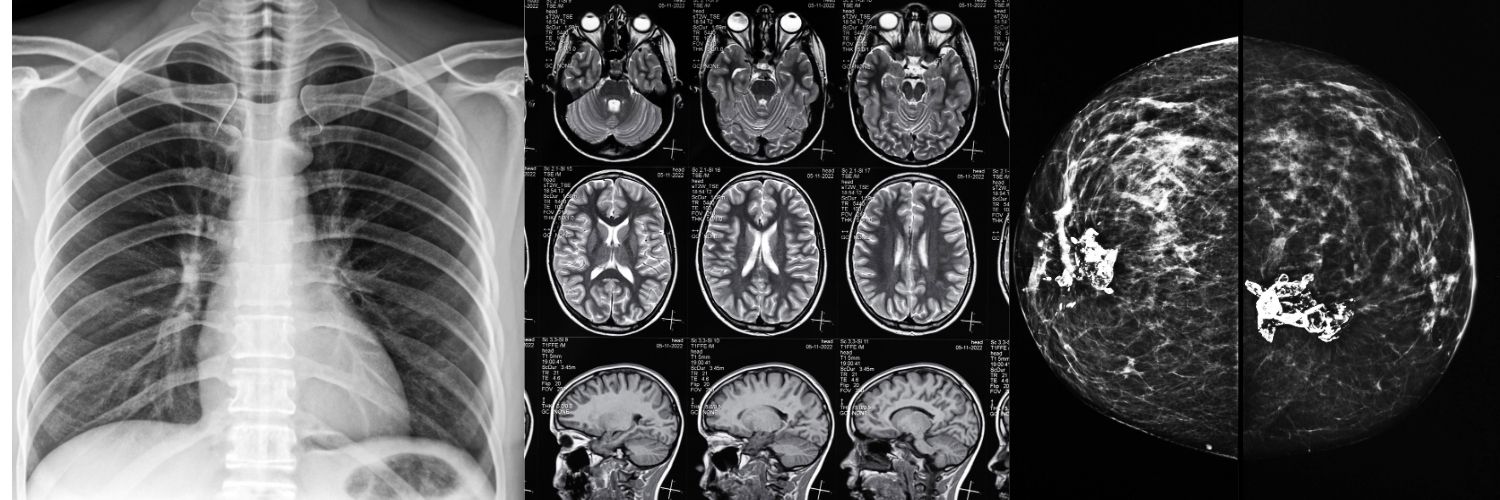 Dr. Segnini Radiologist, Ultrasound Ultrasound Teleradiology Telemedicine Doppler MSK