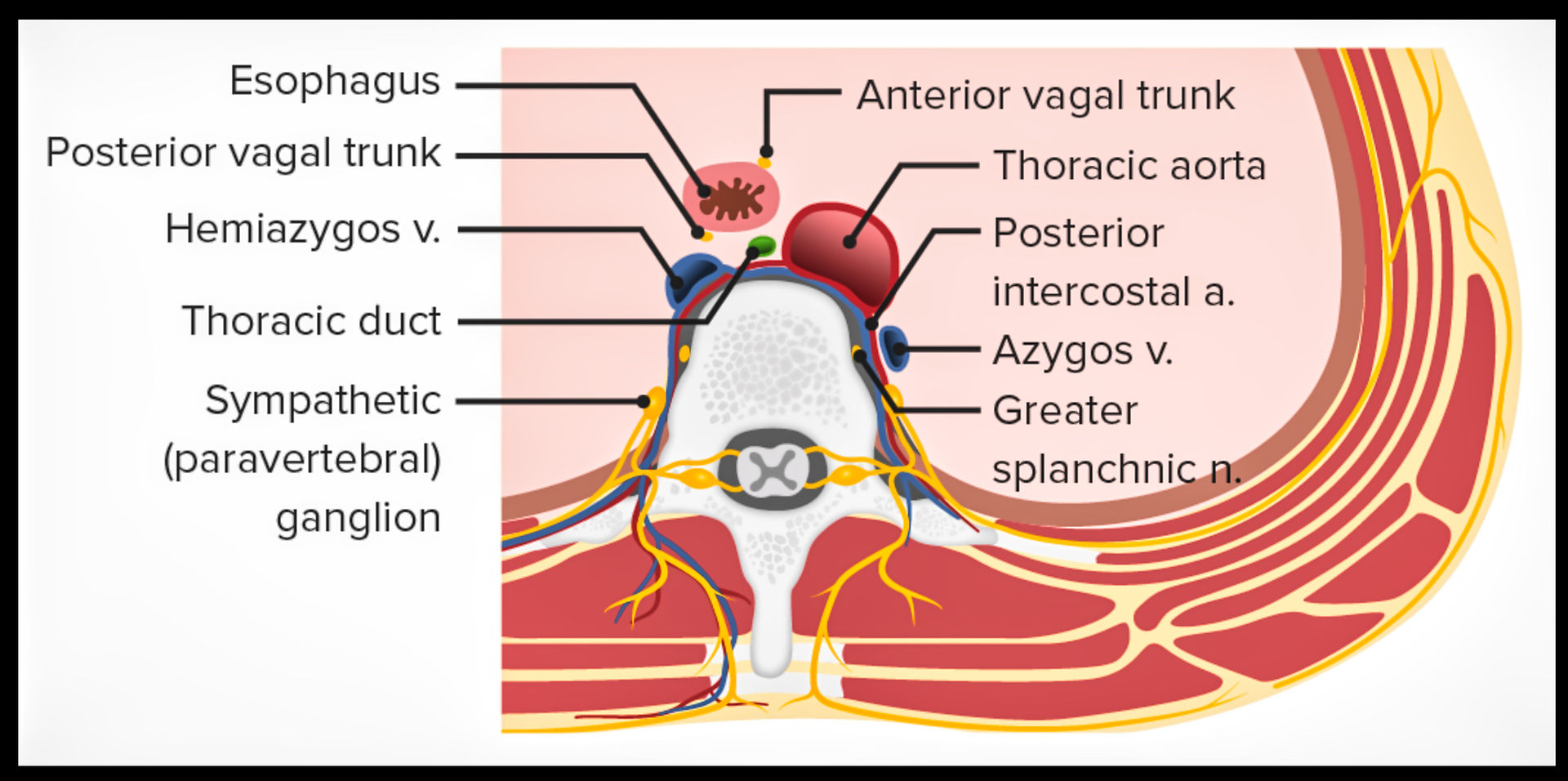 Dr. Segnini mediastino anatomía vasos aorta radiología 