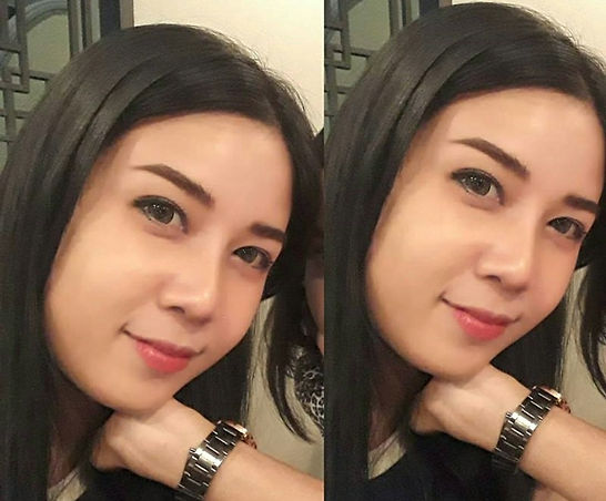 3-2หมอไหนเสริมจมูก อุบลสวย.jpg
