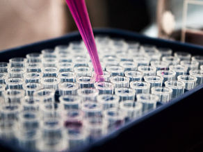 Testing for Chronic Low-Grade Inflammation and Cardiovascular Risk
